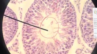 Seminiferous tubules [upl. by Brianna]