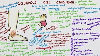 Squamous Cell Carcinoma  Pathology [upl. by Ahseirej]