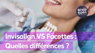 SOINS DENTAIRES  🦷 Invisalign VS Facettes  Quelles différences   BODYEXPERT [upl. by Chavaree]