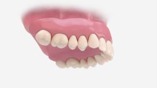 Atlantis Conus concept animation  Dentsply Sirona [upl. by Grand]