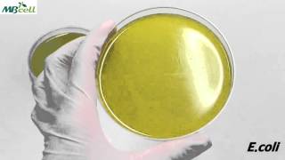 Bacillus Cereus Agar [upl. by Nerrat]