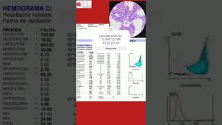 Interpreta el siguiente hemograma hematologia medicina [upl. by Pizor]