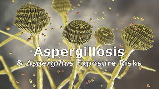 Aspergillosis and Aspergillus Exposure Risks [upl. by Vasileior296]