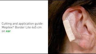 Mepilex Border Lite  application on ear [upl. by Ardene]