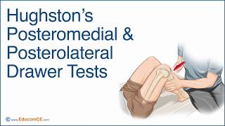 Hughston’s Posteromedial amp Posterolateral Drawer Tests [upl. by Sharia]