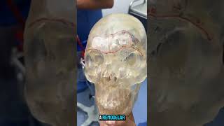 Hablemos de modelos 3d cirujanomaxilofacial [upl. by Dnomasor]