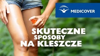 Kleszcz – skuteczne sposoby na kleszcze [upl. by Egerton]