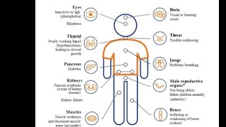 Mystery diagnosis Cystinosis [upl. by Laurance]