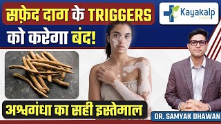 सफ़ेद दाग के Triggers को करेगा बंद  Ashwagandha in Vitiligo Treatment  Kayakalp Global [upl. by Eimmis]