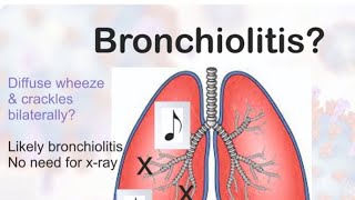 Hospital Training  Pediatrics  Bronchiolitis Dr Sarah 20242025 [upl. by Doll112]