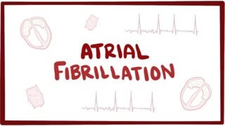 Atrial fibrillation Afib AF  causes symptoms treatment amp pathology [upl. by Zared]