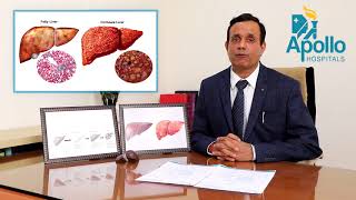 Liver diseases preventionprotection by Dr Shravan Bohra Liver Specialist at Apollo Ahmedabad [upl. by Hacim]