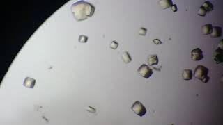 Cristaux dOxalate Calcium ●Urine ●ECBU [upl. by Normi769]