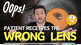 WRONG Lens  How did it happen IOL Exchange during Cataract Surgery [upl. by Arrekahs]