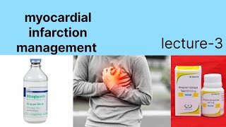 myocardial infarction management lecture3Heart attack management hindi main [upl. by Ruthann]