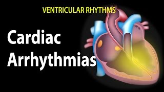 Cardiac Arrhythmias Animation [upl. by Nevaj884]