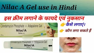 NilacA Gel Review nilaca gel use in Hindi Clindamycin Phosphate  Adapalene Gel Nilaca gel price [upl. by Anamor]