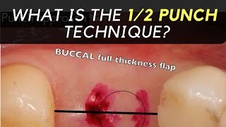 What is the 12 punch technique [upl. by Bernardo]