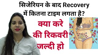 Cesarean ke baad recovery me Kitna time lagta hai  Normal life kb shuru kr sakte h Belly fat [upl. by Dremann]