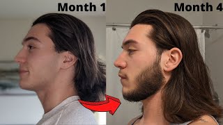 4 MONTH Minoxidil Beard Transformation  Beard Growth Results [upl. by Isabeau]