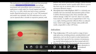 Kanski Clinical Ophthalmology Made Easy  Glaucoma 5 [upl. by Ennirac618]