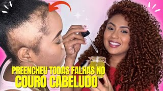 APENAS TRÊS INGREDIENTES O CABELO CRESCE MUITO E NÃO CAI NÃO USE MUITO [upl. by Nylra]