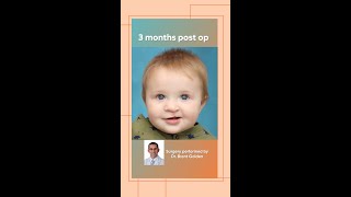 National Cleft and Craniofacial Awareness and Prevention Month [upl. by Ecreip]