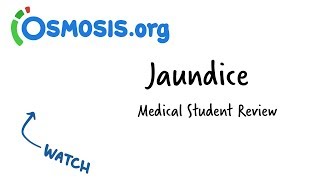 Jaundice  Clinical Presentation [upl. by Ardyth115]