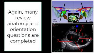 Introduction to the anatomy and orientation of a canine echocardiogram [upl. by Roobbie]