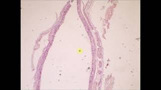 Pseudostratified columnar lining epithelium with goblet cells Nasal Cavity [upl. by Erdnua]