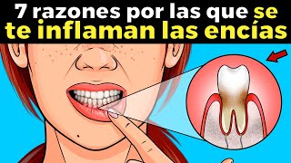 7 razones por las que se te inflaman las encías [upl. by Ennasirk]