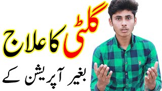 Lipoma Ka Desi ilaj  Gilti ka ilaj in Urdu by Healthin [upl. by Antonius6]