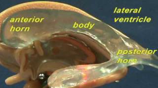 Brain Stem Model  Lateral amp Third Ventricles [upl. by Hamimej]