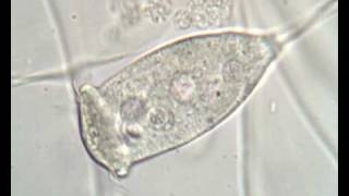 Vorticella sp in activated sludge [upl. by Enimsay11]