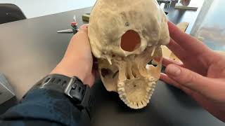 Skull Frontal Parietal and Occipital Bone and their bone markings [upl. by Galanti]