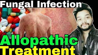 Fungal infection Allopathic Treatment In Hindi  Gyanear [upl. by Nitsur]