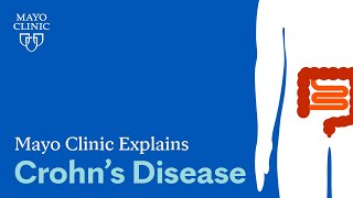 Mayo Clinic Explains Crohn’s Disease [upl. by Dadivitan299]