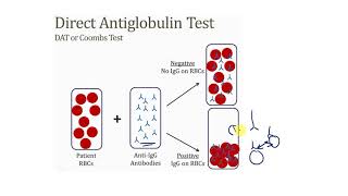 8 Normocytic Anemia Part 24  Extrensic Hemolytic Anemia [upl. by Adnilreh543]