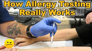 HOW TESTING FOR ALLERGIES REALLY WORKS [upl. by Azrim]