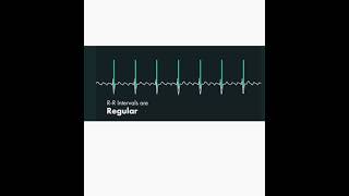 Atrial fibrillation 🆚 Atrial flutter on ECG [upl. by Akimehs69]