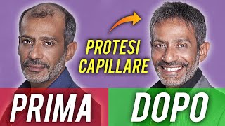 LA PROTESI MI HA CAMBIATO LA VITA  la storia di SIMONE FRATINI [upl. by Armilda]