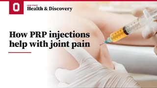 How PRP injections help with joint pain  Ohio State Medical Center [upl. by Maura]