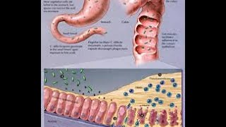 Clostridium Difficile [upl. by Moody746]