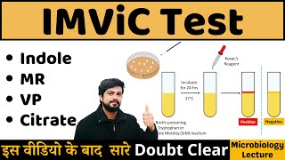 IMViC Test  Indole MR VP Citrate Utilization Test  IMViC Test Procedure in Microbiology [upl. by Leonore]