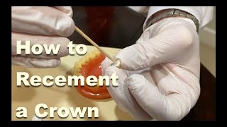 How to Recement a Crown Temporarily  2 Minutes Tuesday with Dr Guerre DDS [upl. by Annua]