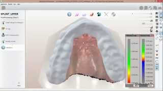 How to design a Bite Splint in 3Shape [upl. by Caron]