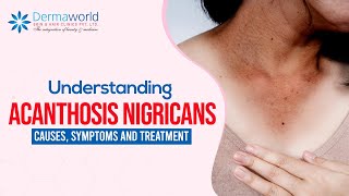 Understanding Acanthosis Nigricans Causes Symptoms and Treatment [upl. by Anialam727]