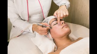 Limpieza facial con punta de diamante ¿En qué consiste [upl. by Haduhey251]