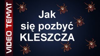 Jak usunąć kleszcza  Skuteczne sposoby na kleszcze [upl. by Lletram]