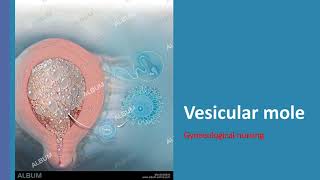 quotVesicular molequot detailed class for nursing students malayalam [upl. by Burl]